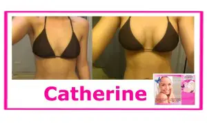 Breast enhancement before and after